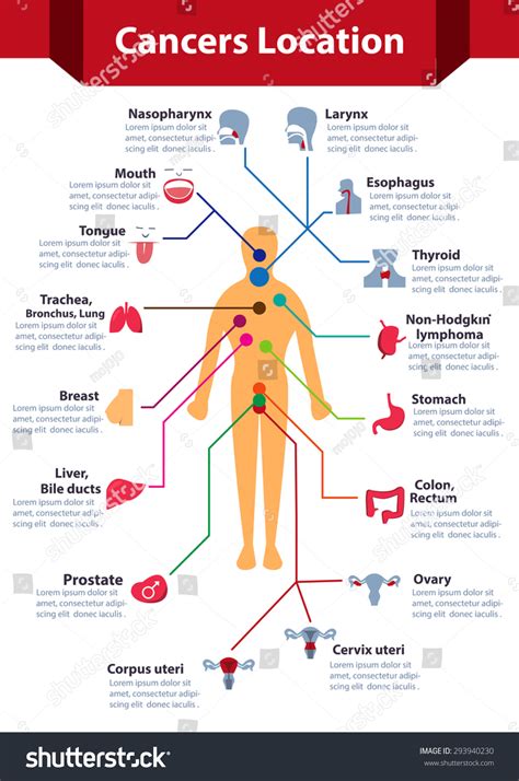 Cancer Infographics Cancer Location On Human Body Map With Colorful