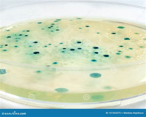 Bacterial Colonies Of Escherichia Coli Stock Image Image Of Culture