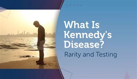 What Is Kennedys Disease Rarity And Testing Mysmateam