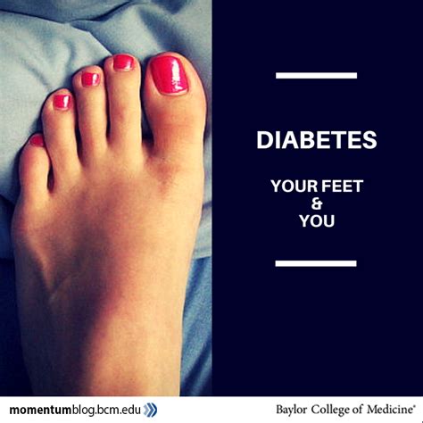 Diabetes Your Feet And You Baylor College Of Medicine Blog Network