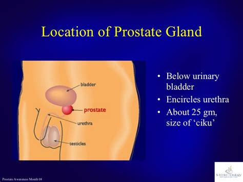 Prostate Cancer or Not