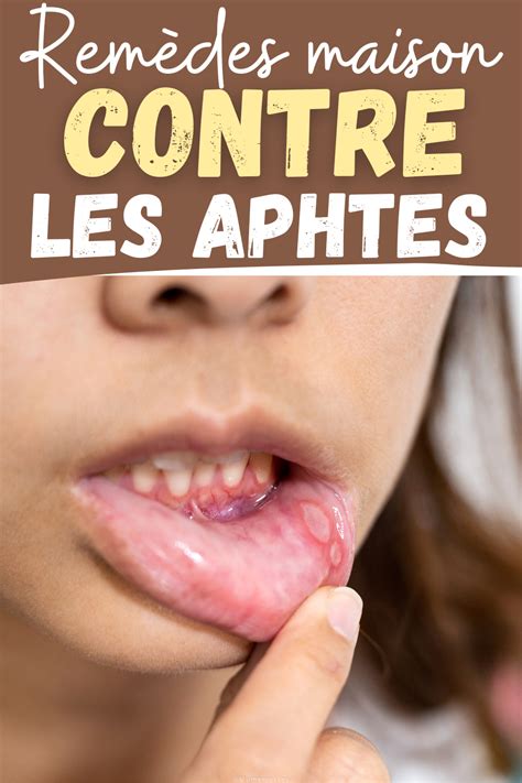 Épinglé Sur Astuce Bien être