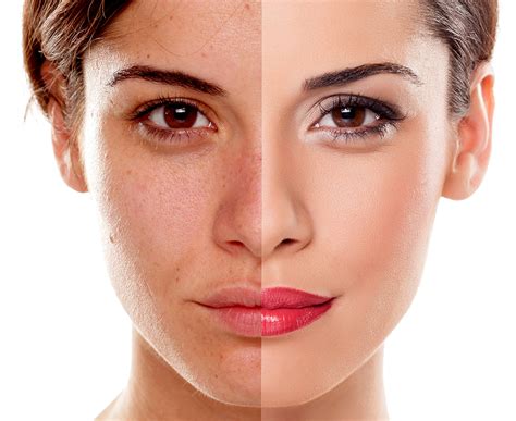 See more ideas about glow, skin treatments, led light therapy. Bb Glow Perfect Skin - Beauty & Soul