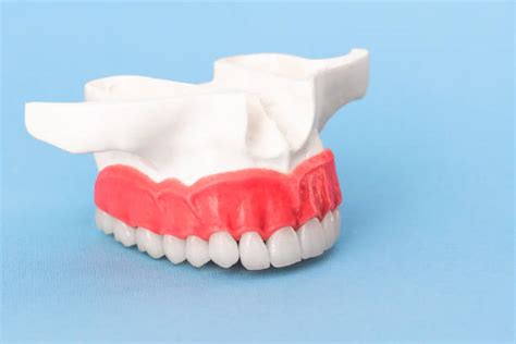 1200 Upper Denture Stock Photos Pictures And Royalty Free Images Istock