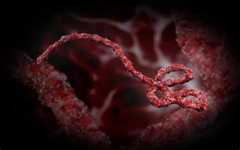 Ebola hemorrhagic fever (ebola virus disease). In Ebola Cure Search, Doctors Expose Virus's Deadly Anti ...