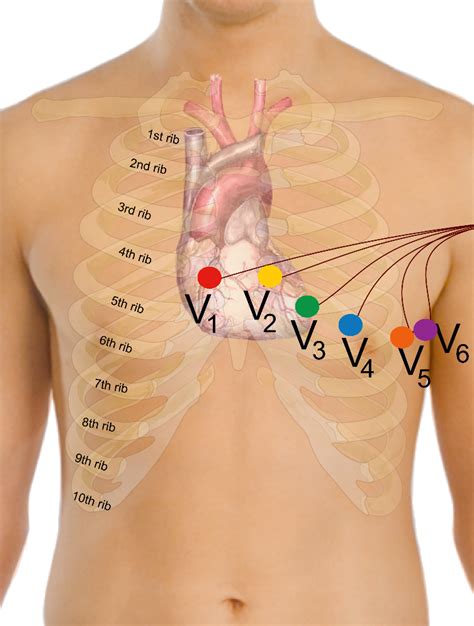 Byop Ekg Electrode Placement Instructions Curavi Health