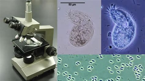 Phase Contrast Microscopy Definition Parts Uses Working Principle