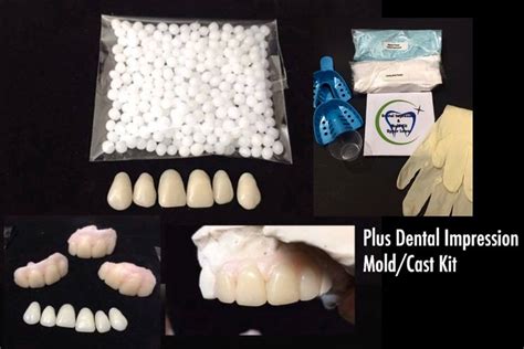 Missing Tooth Veneer Kit Front 6 Teeth Plus Diy Dental Etsy