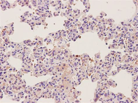 Immunohistochemical Analysis Of Macrophage Infiltration In The Lung