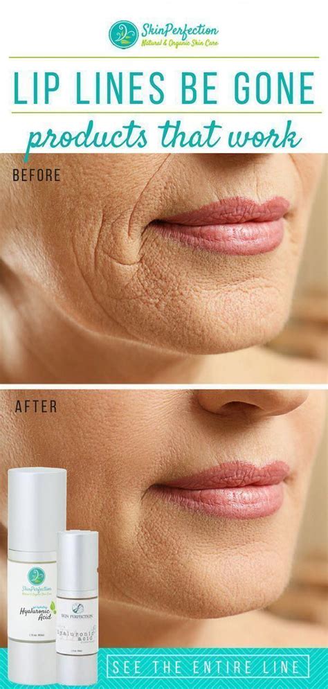 Lip Lines Can Be Minimized With The Right Products And Skincare Routine