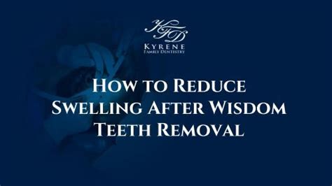 How To Reduce Swelling After Wisdom Teeth Removal