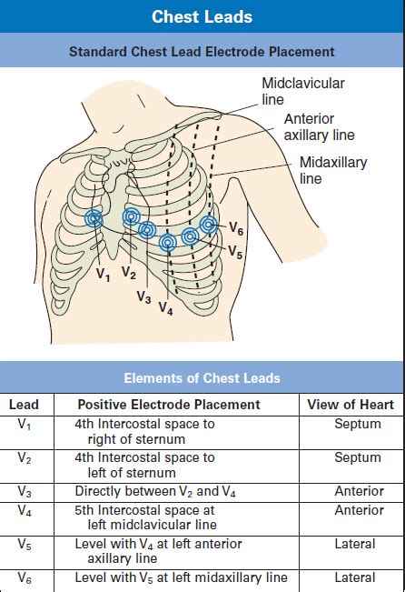 12 Lead Ekg Placement Chart