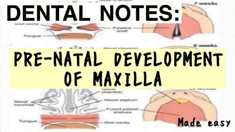 Prenatal Development Of Maxilla Ii Growth Of Maxilla Ii Embryology Ii