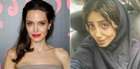 Teen Takes Extreme Measures To Look Like Angelina Jolie