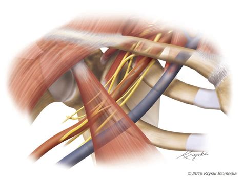 Thoracic Outlet Syndrome And Pitcher Effectiveness • Thoracic Outlet