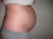 Is this bloating and weight gain normal ????? Do You Have Extreme Bloating? What Causes The Belly To ...