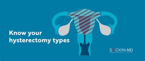 Know Your Hysterectomy Types Seckin Endometriosis Center