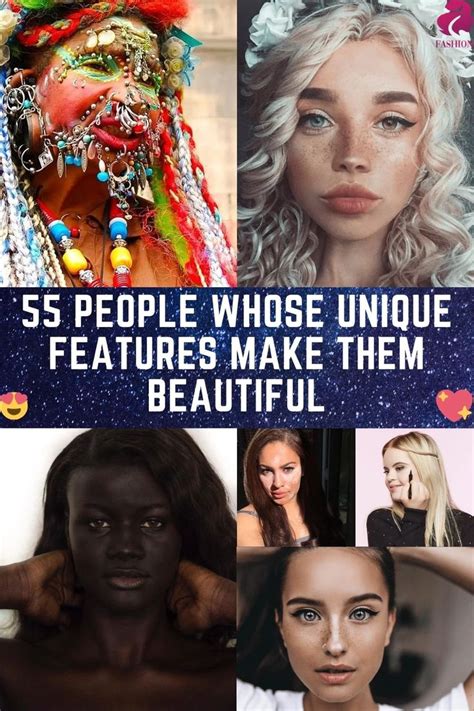 55 People Whose Unique Features Make Them Beautiful Just Amazing