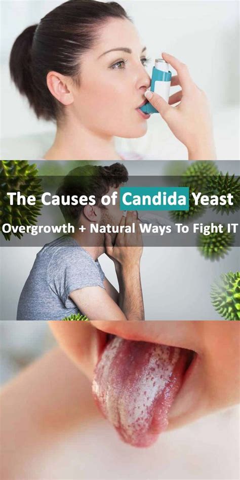 Causes Of Candida Yeast Overgrowth How To Fight It