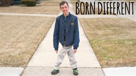 The Incredible Man With Legs Like Scissors Born Different Youtube