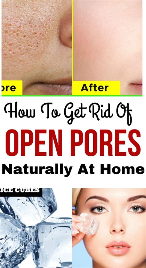 Open Pores Remedy How To Get Rid Of On Face Skin Care Wrinkles Open