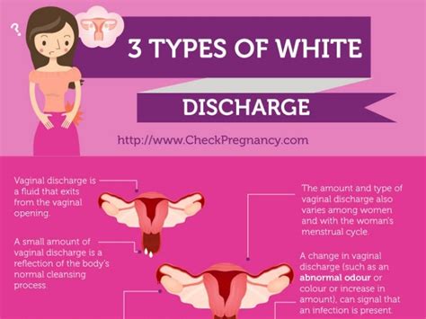 Thick White Discharge 3 Types And What They Mean