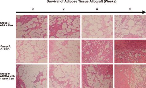 Histologic Examination Of The Adipose Tissue And Bone Marrow Allograft