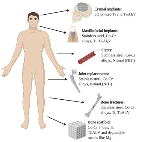 Types Of Metal Implants Used In The Human Body Download Scientific Diagram