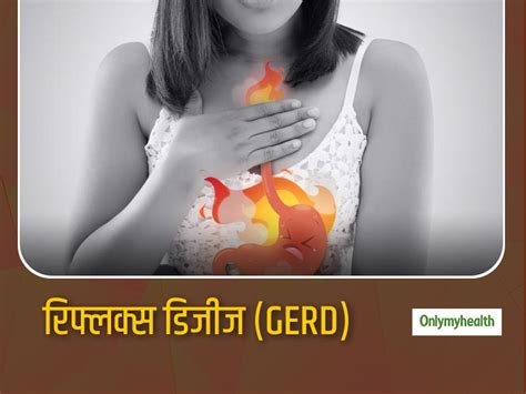 Gerd Acid Reflux In Hindi लाइफस्टाइल से जुड़ी होती हैं पेट की