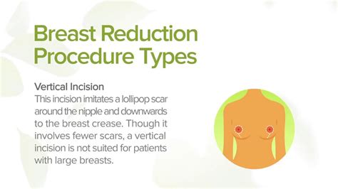 Breast Reduction Benefits Types And Recovery Youtube