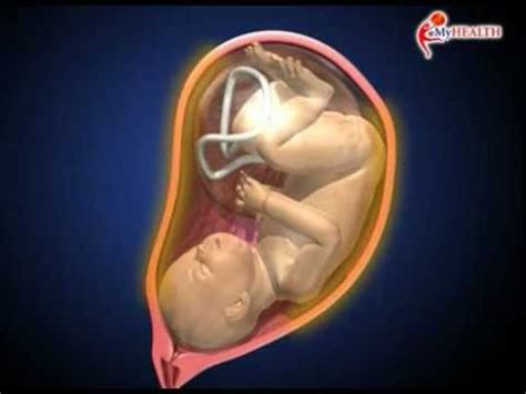 Coba liat animasi persalinan normal ini: MyHEALTH : Proses Kelahiran Bayi - YouTube