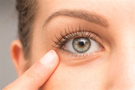 Dark Eyelids Causes Treatments Best Creams Remedies And More