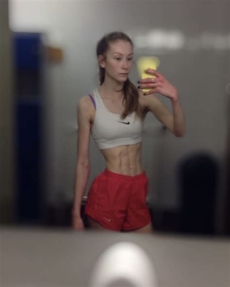 Scots Bodybuilder Who Weighed Just 5st And Refused To Chew Gum During Anorexia Battle Now Eats