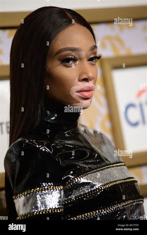 Winnie Harlow Hi Res Stock Photography And Images Alamy