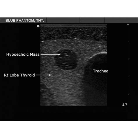 Blue Phantom Thyroid Biopsy Ultrasound Training Model 3012518 Cae