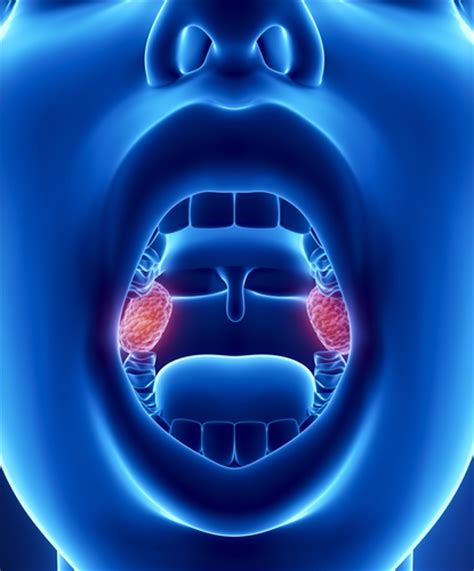 Can Your Tonsils Or Adenoids Grow Back After Surgery Doctor Steven Y