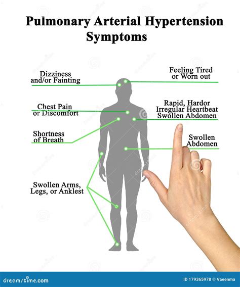 Pulmonary Arterial Hypertension Symptoms Stock Photo Image Of
