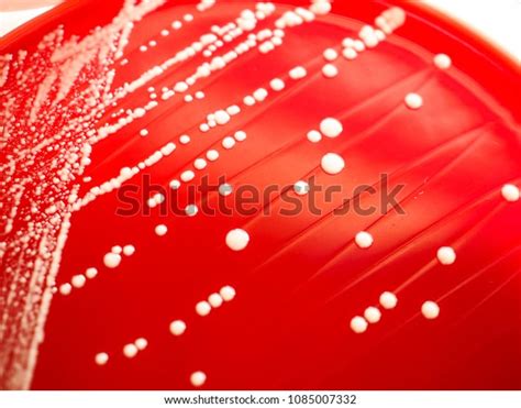 White Colonies Candida Albicans On Blood Stock Photo 1085007332