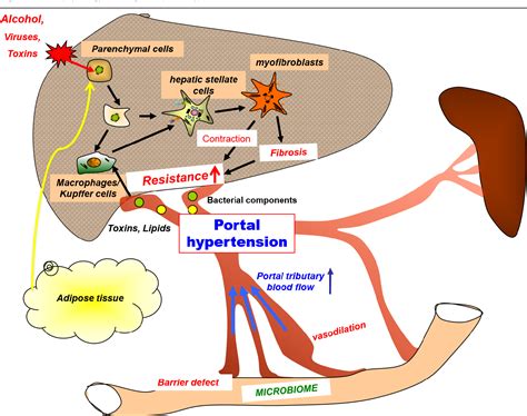 Diagram Pathophysiology Of Liver Cirrhosis Ppt Hypertency Portal