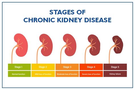 10 Kidney Disease Symptoms You Shouldnt Ignore