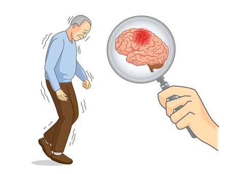 Causes Parkinson S Disease Brain