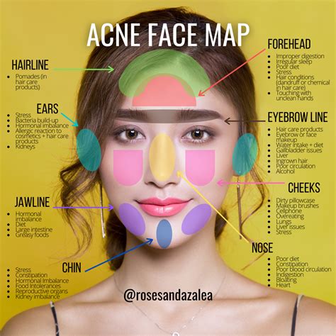 Natural Face Skin Care Body Skin Care Acne Mapping Pimple Face