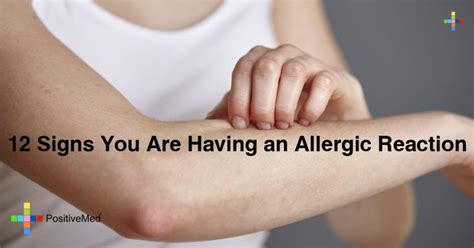 12 Signs You Are Having An Allergic Reaction Positivemed