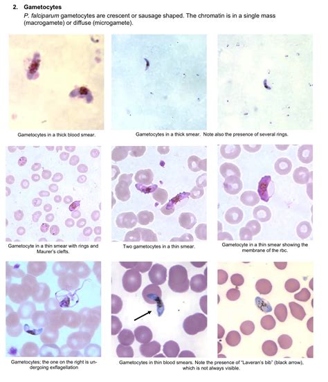 The Life Cycle Of Plasmodium Falciparum Plasmodium Falciparum