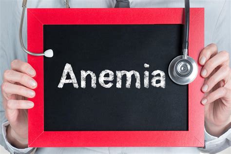 Anemia objawy i przyczyny Jak leczyć anemię PoradnikZdrowie pl