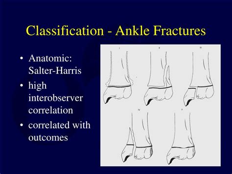 Ao Classification Of Ankle Fractures