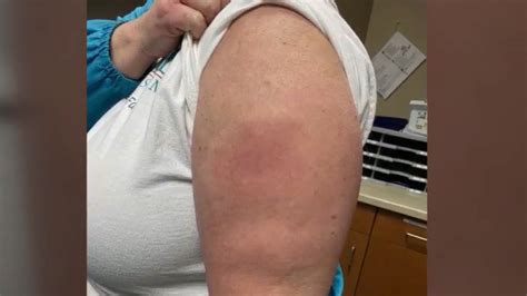 As published on medicine.news, the nejm was recently caught up with the. Moderna Side Effects First Dose - What Are The Side ...