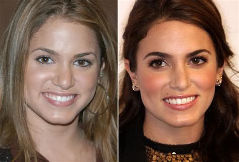 All in all, my first job was a very positive experience. Nikki Reed Nose Job
