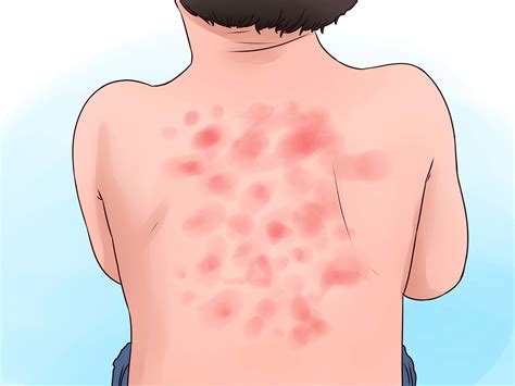 The clinical fixing may not be available in adequate sum. How to Take Bee Pollen - wikiHow
