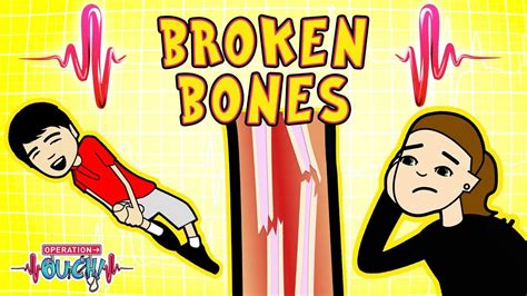 See more of kids of the broken homes on facebook. Science for kids | Body Parts - BROKEN BONES | Experiments ...